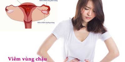 luu-y-khi-kham-va-dieu-tri-viem-vung-chau