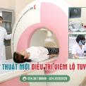 cac-phuong-phap-chua-benh-viem-lo-tuyen-tai-da-khoa-quoc-te-ha-noi